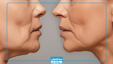 بهترین دکتر رفع غبغب در شیراز