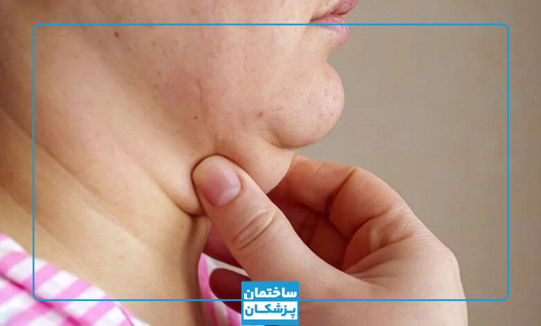 روش های رفع غبغب