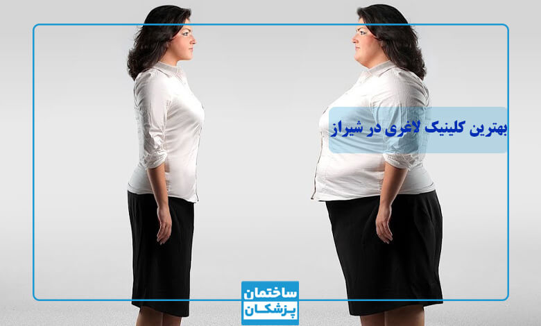 لیست بهترین کلینیک لاغری در شیراز