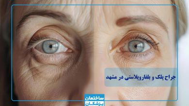 بهترین جراح پلک در مشهد