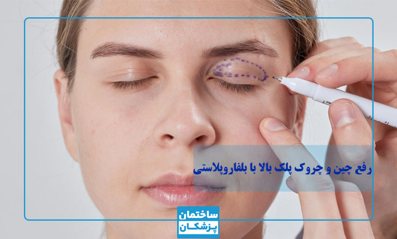 رفع چین و چروک پلک بالا با کمک بلفاروپلاستی
