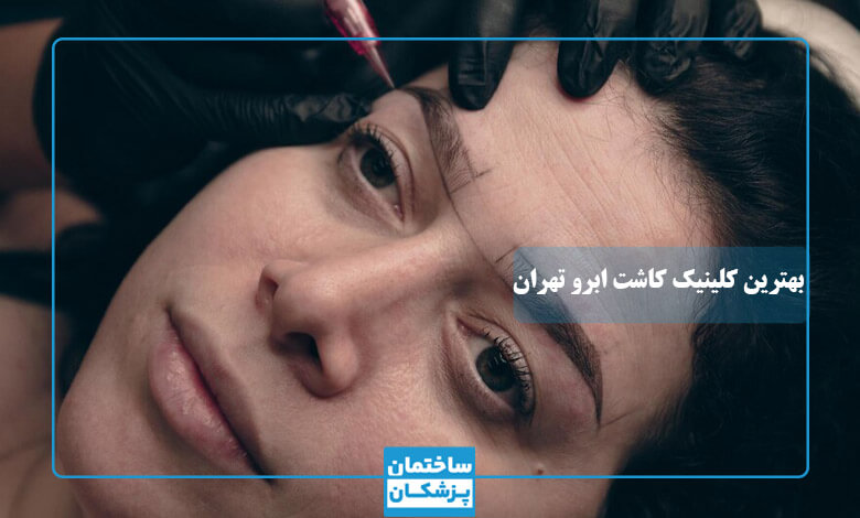 لیست بهترین کلینیک کاشت ابرو در تهران