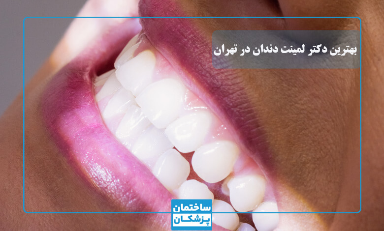 لمینت بهتر است یا کامپوزیت؟