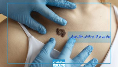 بهترین مرکز برداشتن خال در تهران