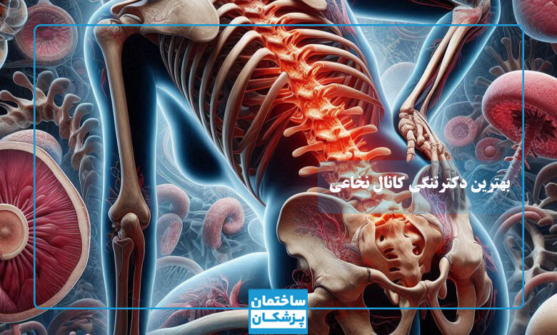 بهترین جراح تنگی کانال نخاعی در تهران