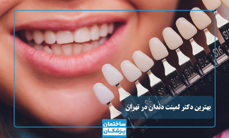 لمینت دندان چیست
