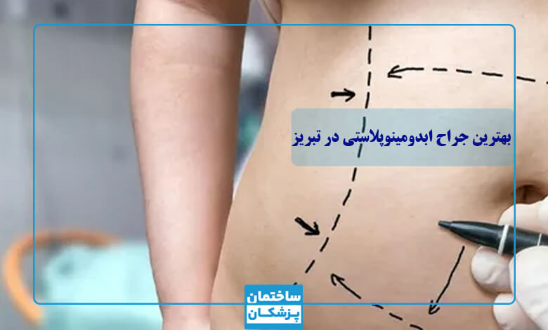 بهترین دکتر ابدومینوپلاستی در تبریز