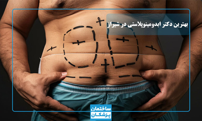 لیست بهترین جراحان ابدومینوپلاستی در شیراز