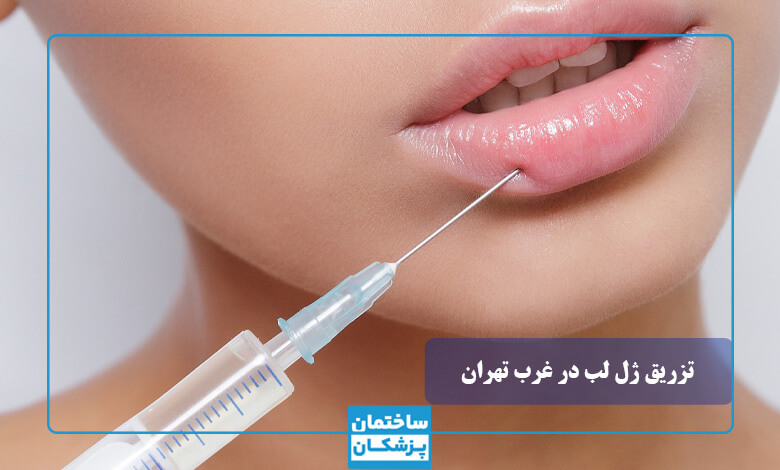 بهترین برند تزریق ژل لب چیست
