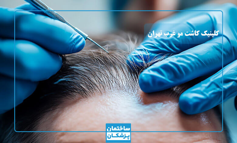 معیارهای مهم در انتخاب بهترین کلینیک کاشت مو در غرب تهران