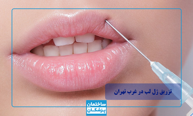 توصیه های مهم بهترین دکتر غرب تهران برای تزریق ژل لب