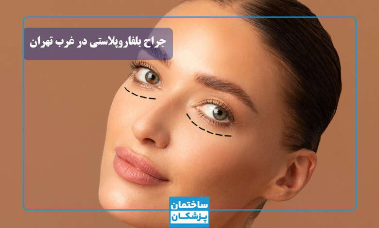 فاکتورهای مهم در انتخاب بهترین جراح بلفاروپلاستی غرب تهران