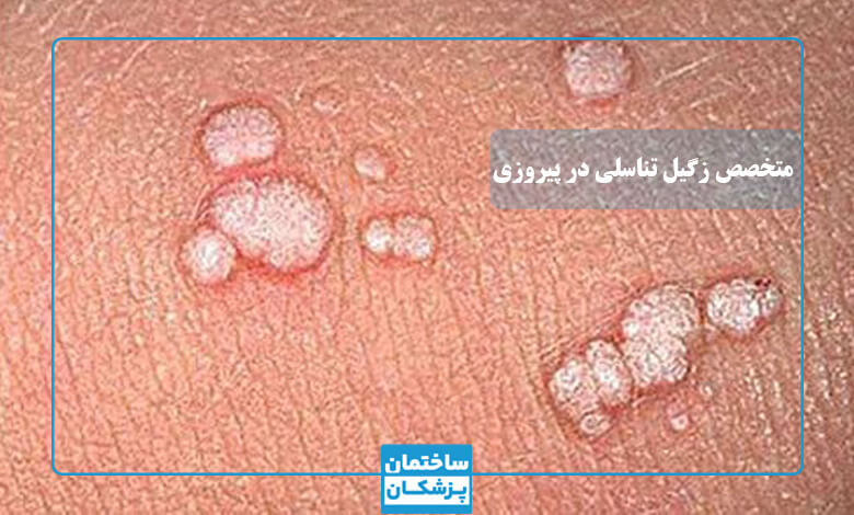 معیارهای مهم در انتخاب بهترین دکتر زگیل تناسلی در پیروزی