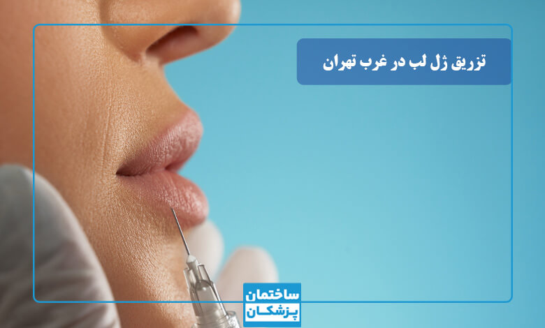 معیارهای مهم در انتخاب بهترین دکتر تزریق ژل لب در غرب تهران