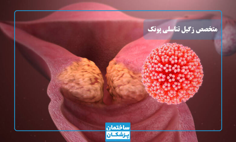 معیارهای مهم در انتخاب بهترین متخصص زگیل تناسلی در پونک