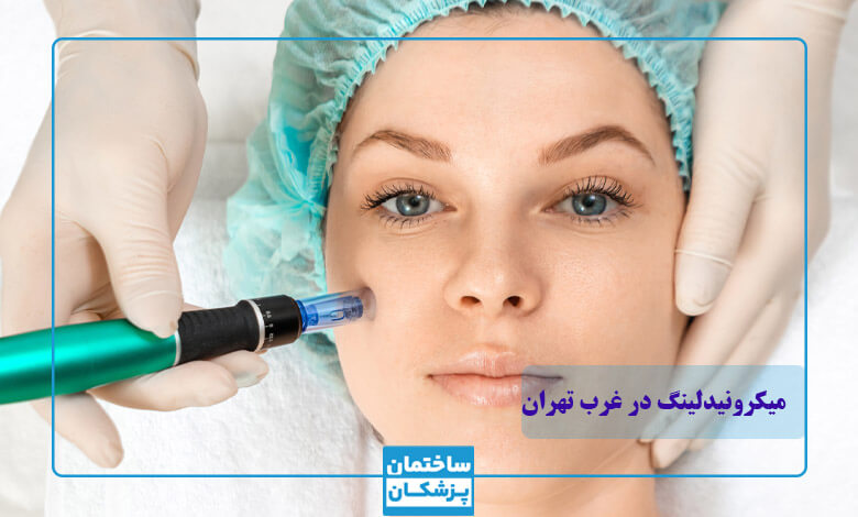 معیارهای مهم در انتخاب بهترین کلینیک میکرونیدلینگ در غرب تهران