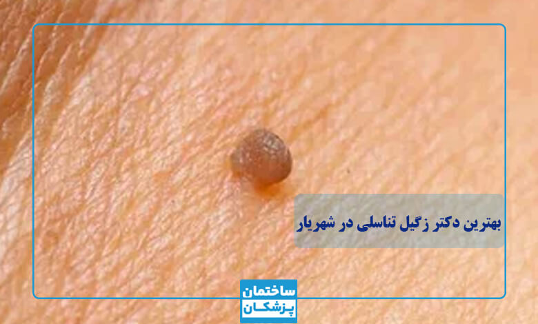 بهترین دکتر زگیل تناسلی در شهریار