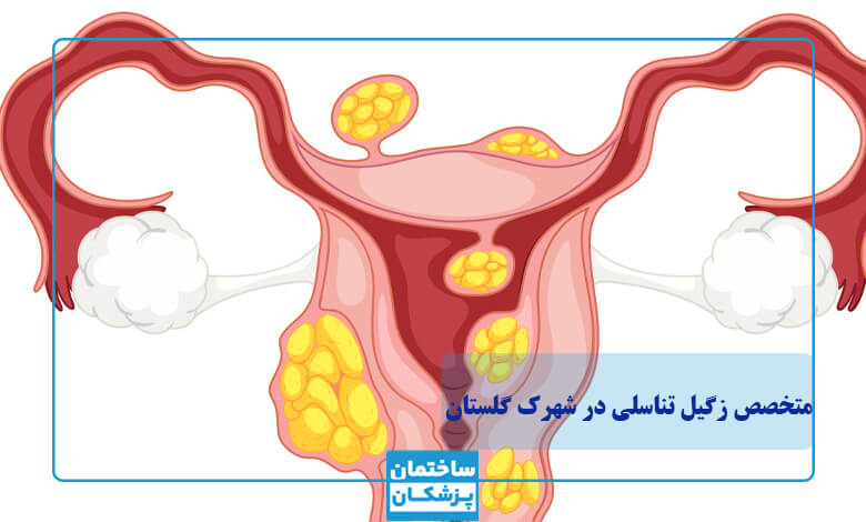 معیارهای انتخاب بهترین متخصص زگیل تناسلی در شهرک گلستان
