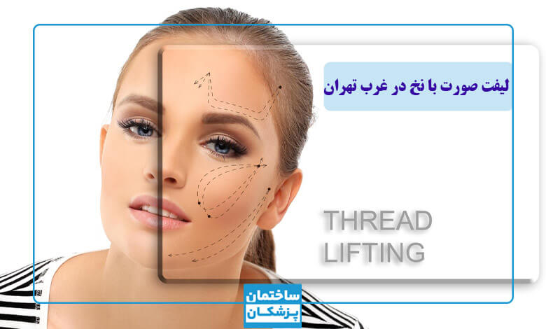 سوالات متداول در مورد لیفت صورت با نخ
