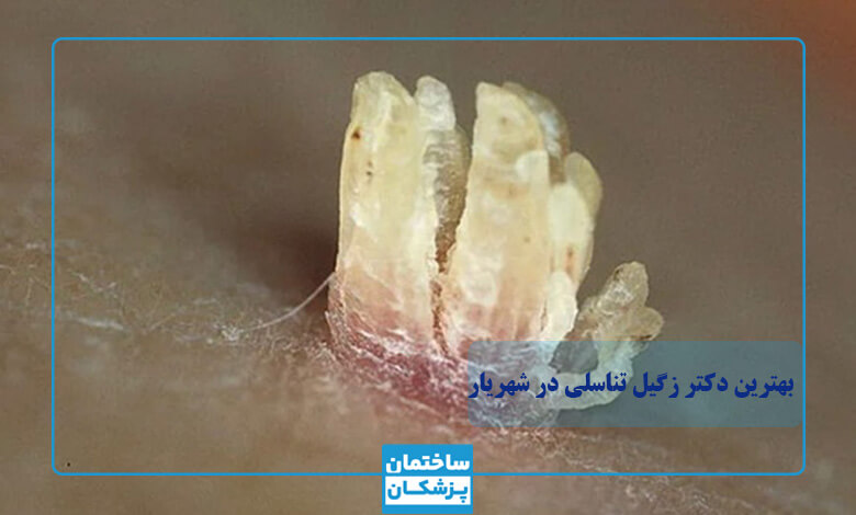 مشخصات بهترین دکتر زگیل تناسلی در شهریار