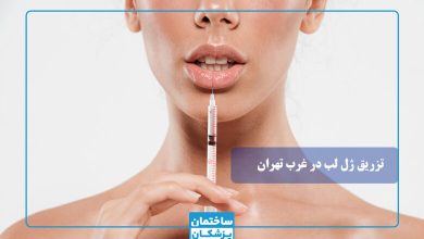 بهترین دکتر تزریق ژل لب در غرب تهران