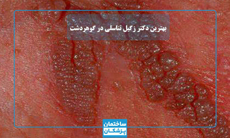 لیست بهترین متخصص زگیل تناسلی در گوهر دشت