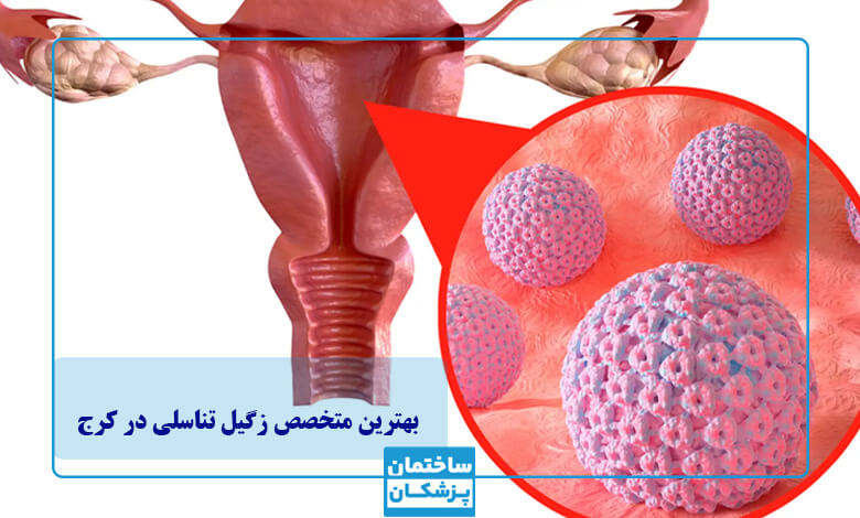 بهترین روش درمان زگیل تناسلی در زنان و مردان