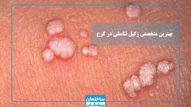 بهترین متخصص زگیل تناسلی در کرج