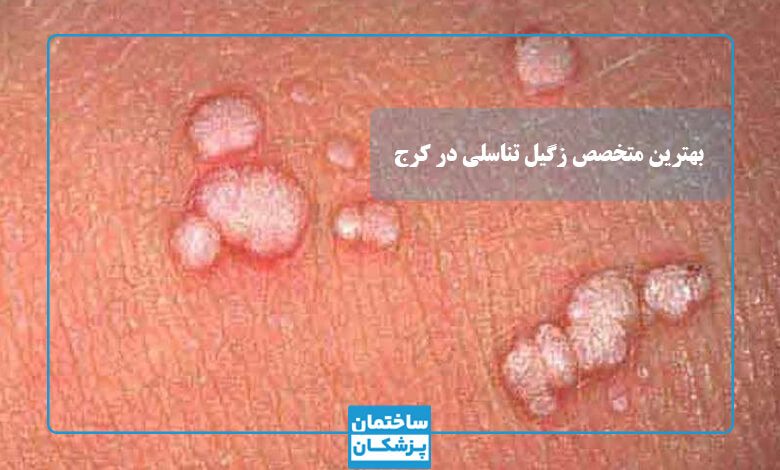 بهترین متخصص زگیل تناسلی در کرج
