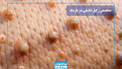 بهترین متخصص زگیل تناسلی در نارمک