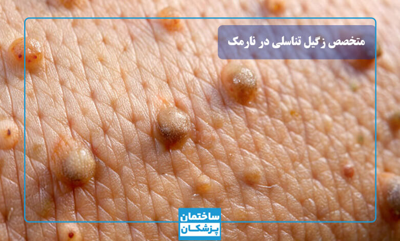 بهترین متخصص زگیل تناسلی در نارمک