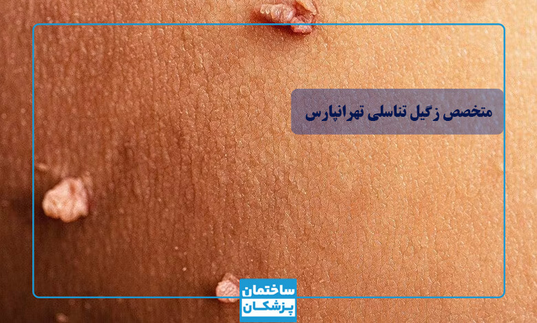 بهترین متخصص زگیل تناسلی در تهرانپارس