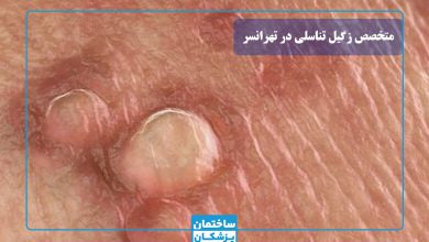 بهترین متخصص زگیل تناسلی در تهرانسر