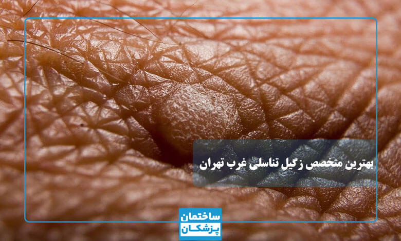بهترین متخصص زگیل تناسلی در غرب تهران