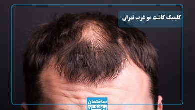 بهترین کلینیک کاشت مو در غرب تهران