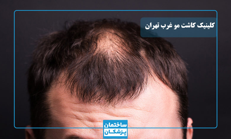 بهترین کلینیک کاشت مو در غرب تهران