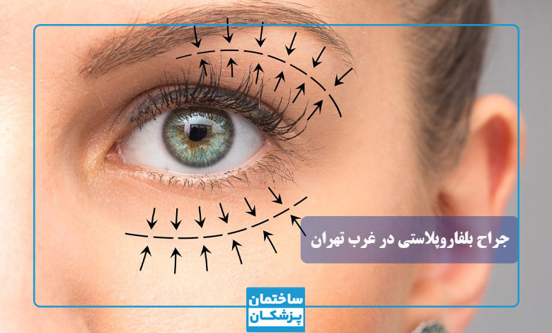 چرا مراجعه به بهترین جراح بلفاروپلاستی اهمیت دارد؟