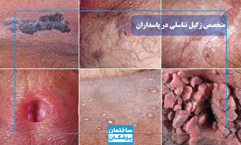 انواع زگیل تناسلی و علت به وجود آمدن آن