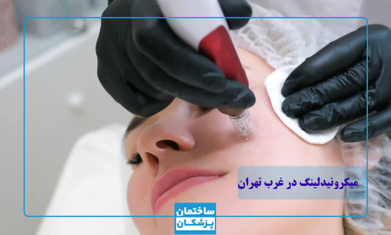 بهترین مراکز میکرونیدلینگ در غرب تهران