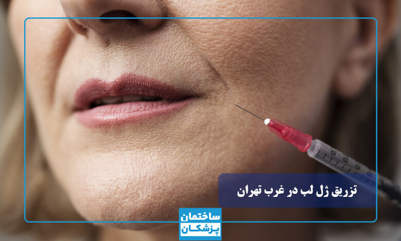 هزینه تزریق ژل لب در غرب تهران