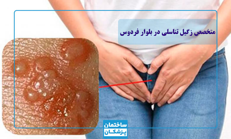 علائم زگیل تناسلی