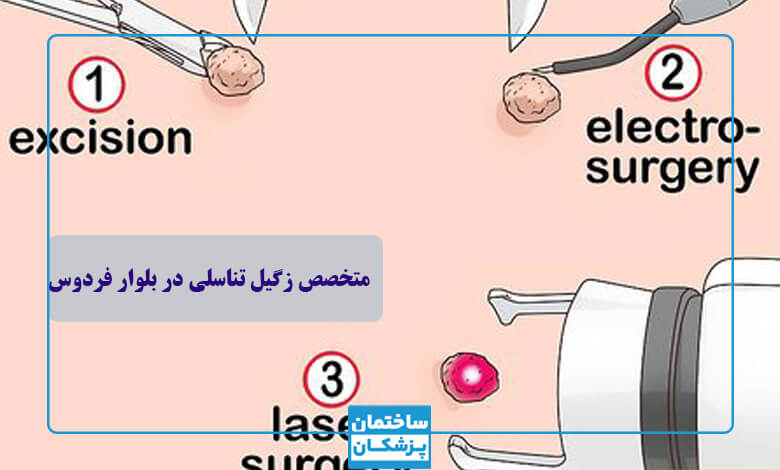 راه های درمان زگیل تناسلی