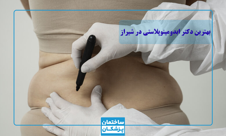 انواع روش های ابدومینوپلاستی در شیراز