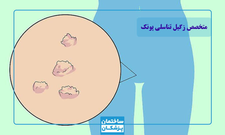 زگیل تناسلی چیست و چه علائمی دارد