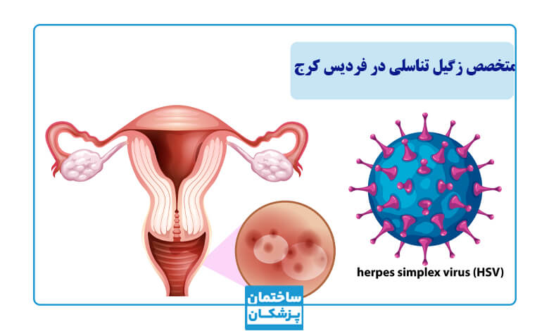توصیه های ضروری بهترین متخصص زگیل تناسلی فردیس کرج