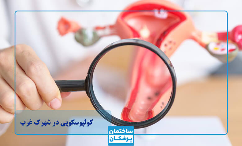 معرفی بهترین متخصص کولپوسکوپی در شهرک غرب