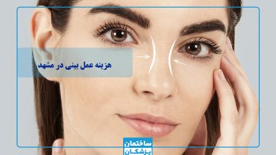 هزینه عمل بینی در مشهد