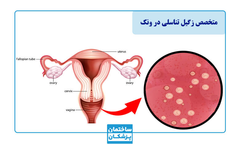 زگیل تناسلی چیست و چقدر شایع است؟
