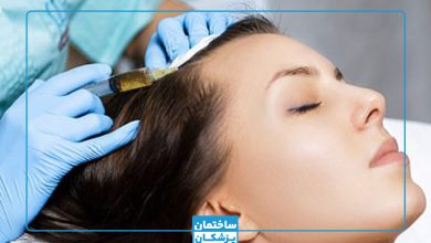 بهترین مرکز مزوتراپی مو در غرب تهران