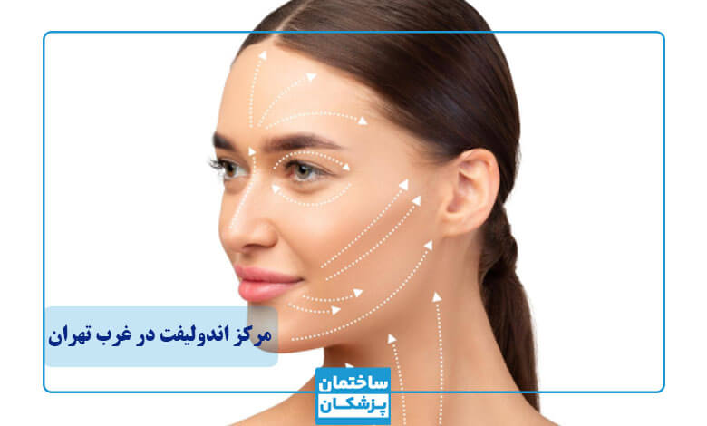 ویژگی های بهترین مرکز اندولیفت در غرب تهران